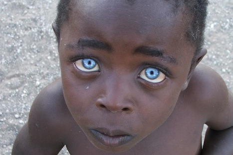 FOTOS: Conoce al niño africano de los ojos de zafiro