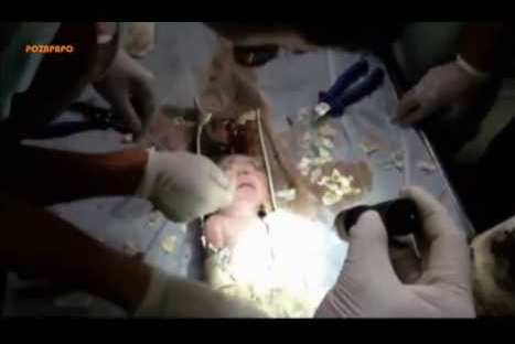 China: rescatan a recién nacido de tubería de un inodoro - VIDEO