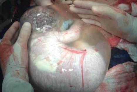 Médico fotografía a bebé cuando aun se encontraba en su saco amniótico