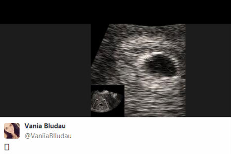 Vania Bludau aclaró rumores sobre embarazo  (FOTOS)
