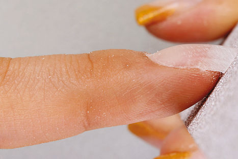 Tus uñas podrían decir mucho sobre tu estado de salud