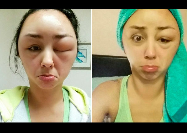 Facebook: Mujer se aplicó tinte de cabello y quedó desfigurada (FOTOS)