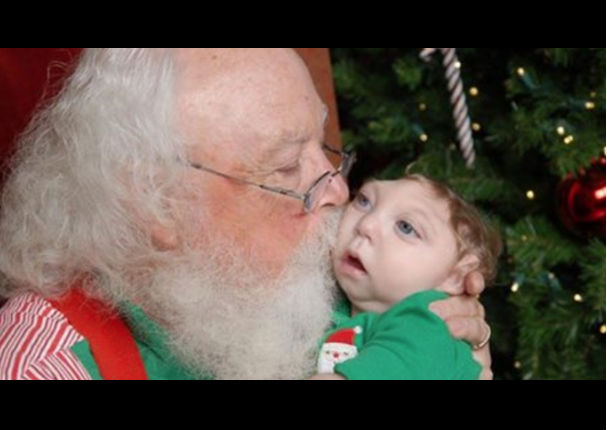 Él es Jaxon Strong, el pequeño con medio cerebro que conoció a Santa Claus