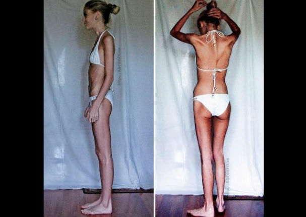 Instagram: Ella luchó contra la anorexia y ahora luce increíble (FOTOS)
