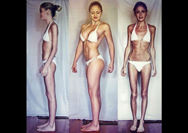 Instagram: Ella luchó contra la anorexia y ahora luce increíble (FOTOS)