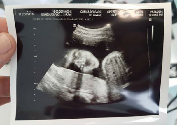 Jesús Alzamora conmueve Facebook con ecografía de su bebé (FOTO)