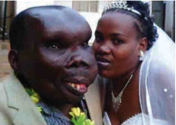 Resultado de imagen para Tiene 8 hijos con “el hombre más feo del mundo”