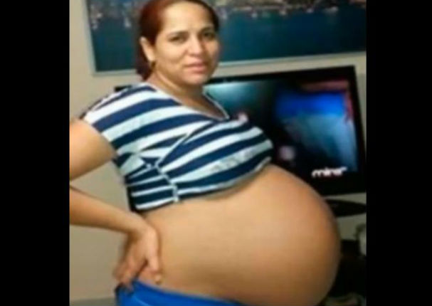 YouTube: Lleva 18 meses 'embarazada' y los doctores le dieron esta noticia