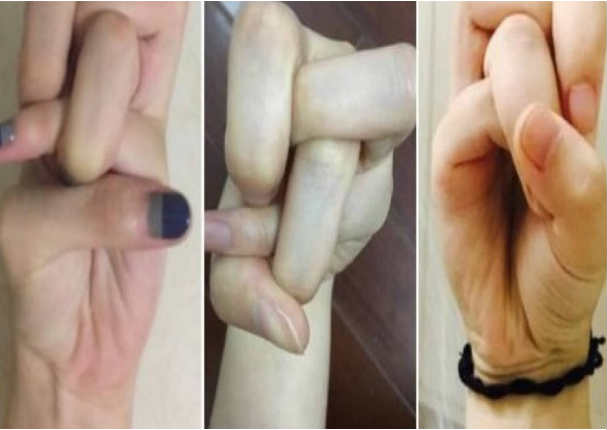 Este el reto con dedos que circula en Internet (FOTOS)