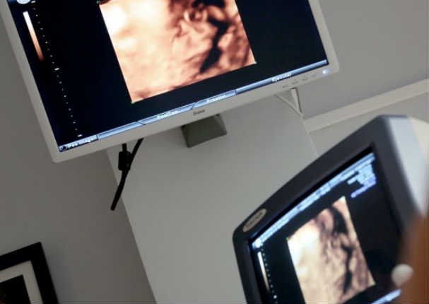 Se realizó ultrasonido y la imagen de su bebé fue de terror