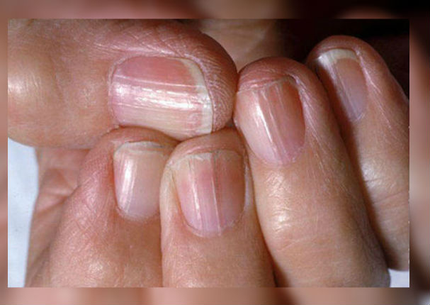 Tus uñas podrían decir mucho sobre tu estado de salud