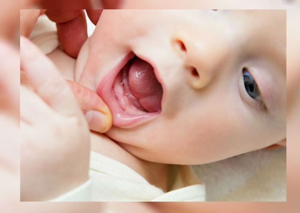Padres: ¿Cómo cuidar la higiene bucal de tu bebé? (VIDEO)