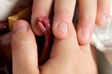 Thumb