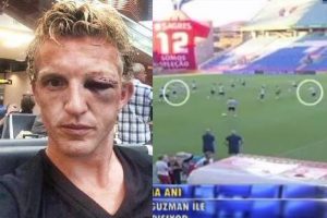 Así quedó delantero holandés tras chocar de cara con compañero – VIDEO
