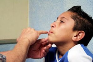 ‘Operación Sonrisa’ comienza ciclo de operaciones el 08 de noviembre