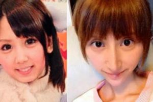 Actriz porno se operó y se parecía a Dobby de Harry Potter