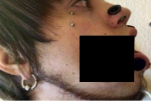 Aterrador: joven modificó su rostro para comer por su mejilla- VIDEO