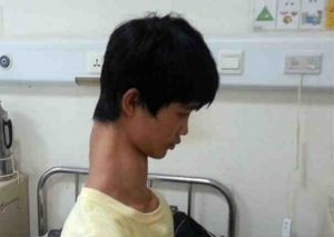 Conoce la historia del ‘joven jirafa’ (FOTOS)