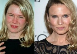 Renée Zellweger resta importancia a críticas sobre su impresionante cambio de look