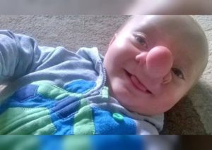 Lo conocen como el ‘Pinocho de la vida real’, pero su caso es muy conmovedor