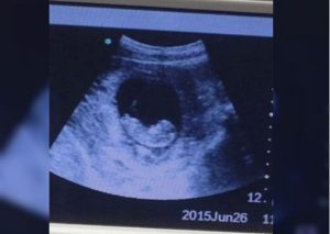 ¿Es real? Ecografía muestra a figura ‘demoniaca’ que vigila a un feto