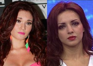 Verano Extremo: Estas son las heridas que dejó Génesis Tapia a Rosángela Espinoza – FOTOS