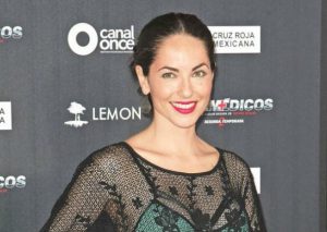 Bárbara Mori fue brutalmente atacada en la pierna por 4 perros (FOTO)
