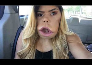 YouTube:  Conoce a la youtuber que rompió el tabú de la belleza