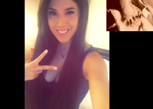¡La puso mal! Yahaira Plasencia en reservado estado de salud