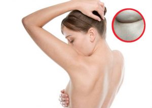 Tips: 6 señales para detectar el cáncer de mama