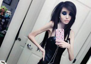 YouTube: Piden cerrar cuenta a joven que pesa 27 kilos y tiene casi de 900.000 seguidores