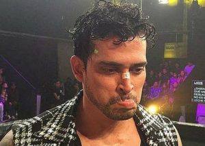 Christian Domínguez: Así luce tras operación a la nariz – FOTOS