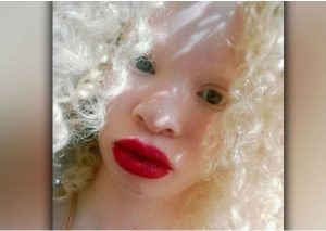Viral: Le decían ‘niña fantasma’ y  ahora da tremenda lección de vida