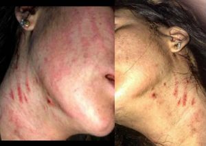Exchica reality sufre brutal agresión y es acusada de ser ‘dama de compañía’