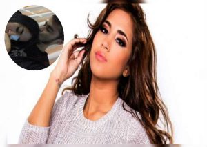 Melissa Paredes reaparece en las redes tras sufrir fuerte accidente en el rostro