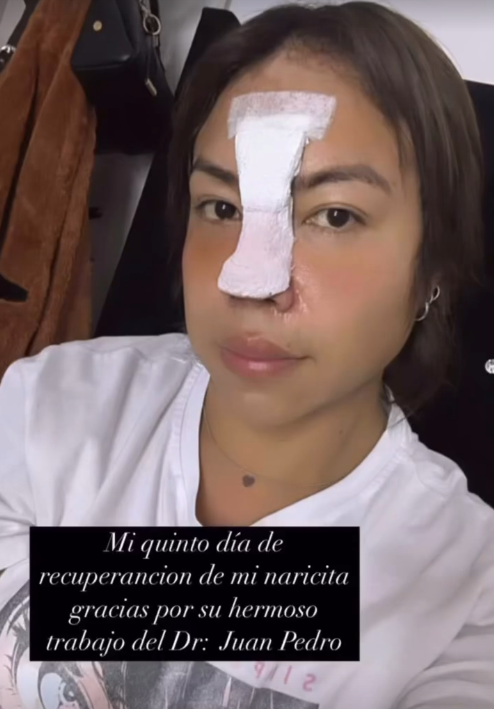 Dayanita se operó la nariz