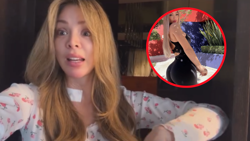 Sheyla Rojas fue intervenida de emergencia por celulitis infecciosa: “Me quemaba la piel”